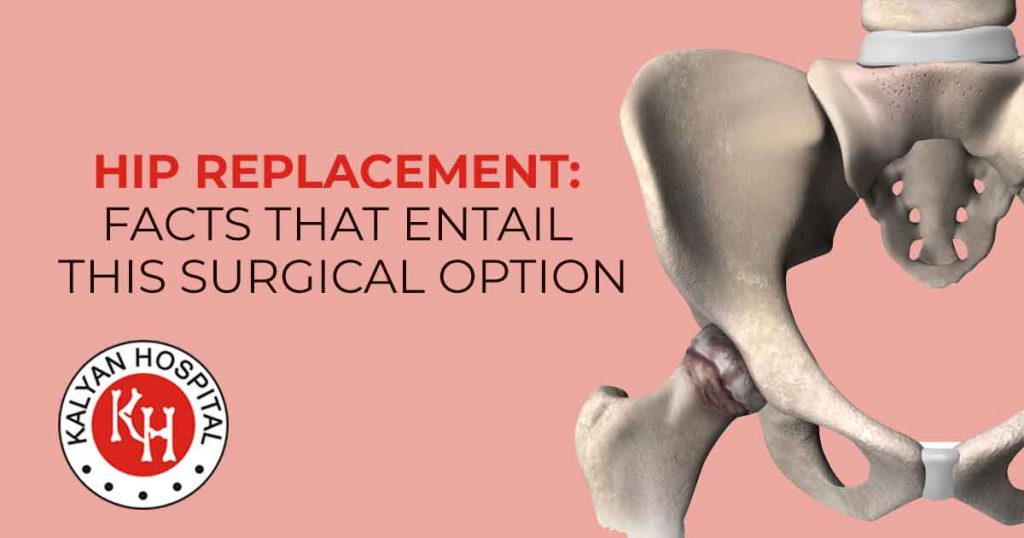 Hip-Replacement-Facts-That-Entail-This-Surgical-Option
