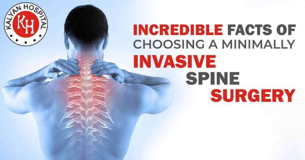 Incredible Facts of Choosing a Minimally Invasive Spine Surgery