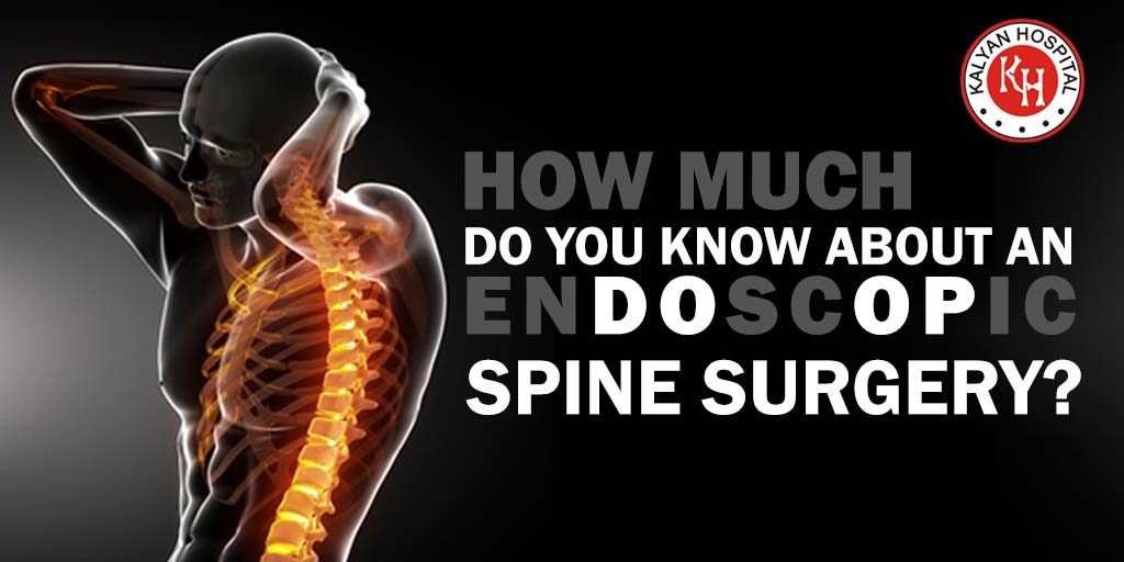 How Much Do You Know About An Endoscopic Spine Surgery?