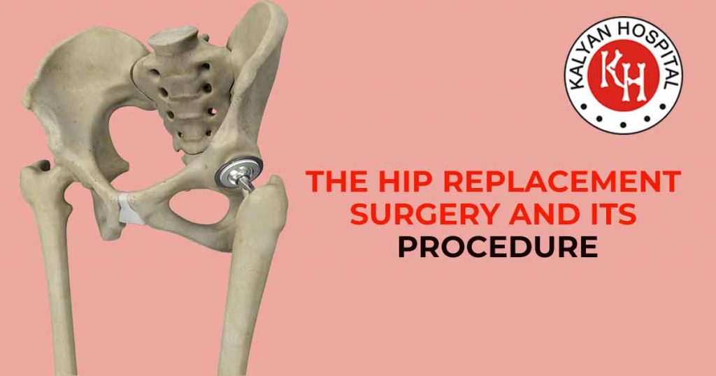 The Hip Replacement Surgery And Its Procedure