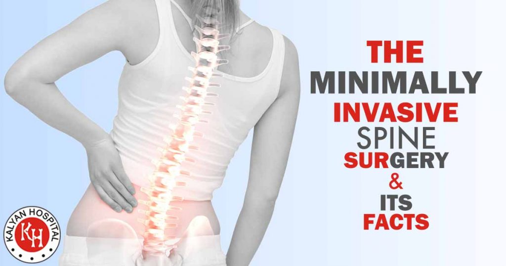 The Minimally Invasive Spine Surgery & Its Facts