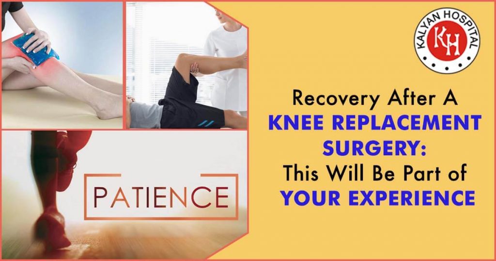 Recovery After A Knee Replacement Surgery: This Will Be Part of Your Experience