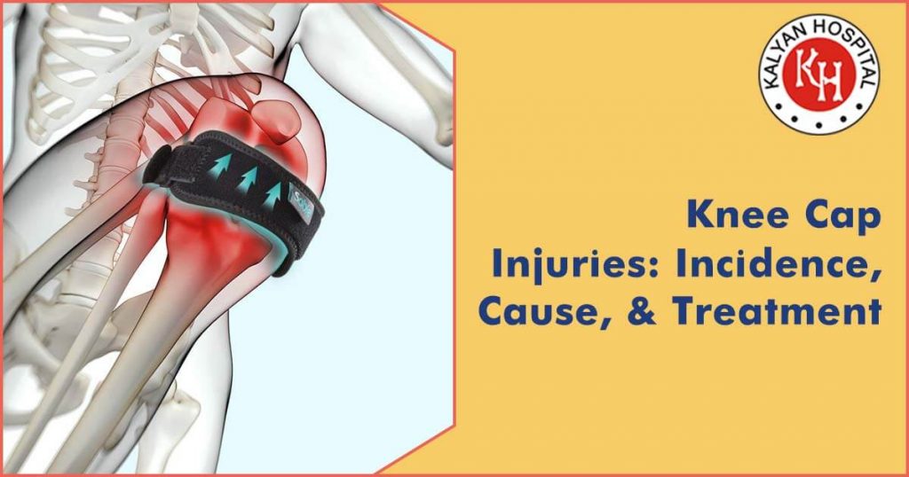 Knee Cap Injuries: Incidence, Cause, & Treatment