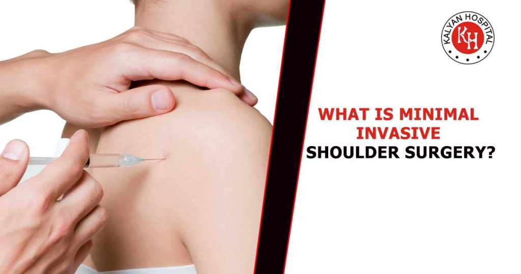 What is minimal invasive shoulder surgery?
