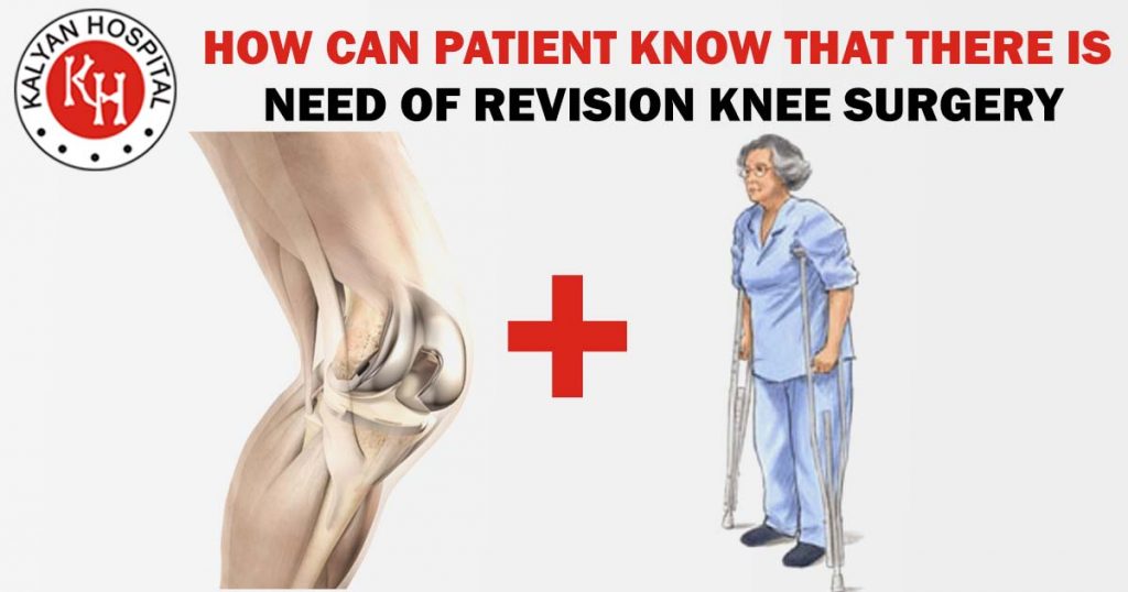 How can patient know that there is need of revision knee surgery?