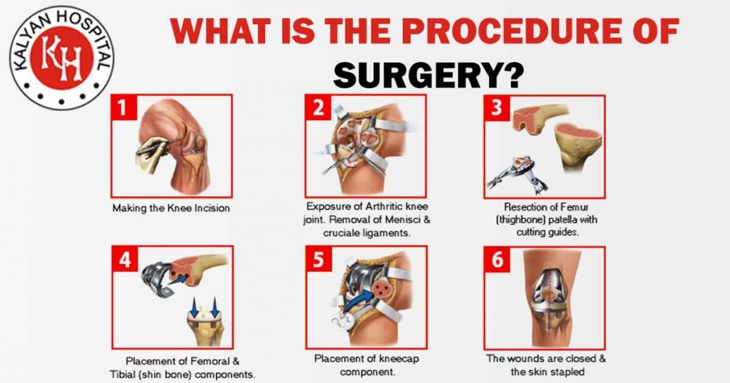 What is the procedure of surgery?