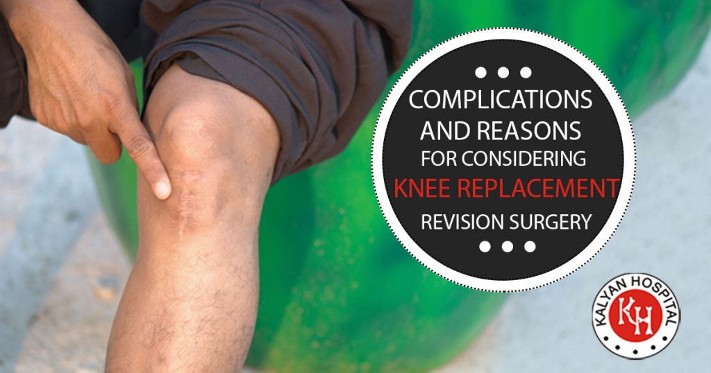 Complications And Reasons For Considering Knee Replacement Surgery