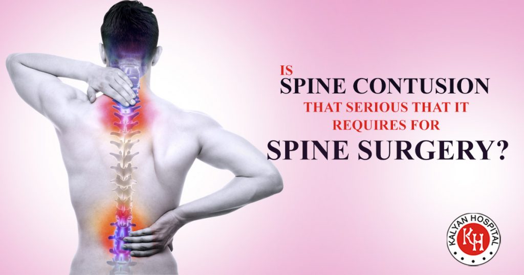 Is Spine Contusion that Serious that it requires For Spine Surgery