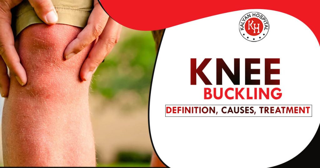 Knee buckling - Definition, Causes, Treatment