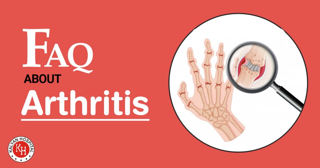 FAQ about arthritis