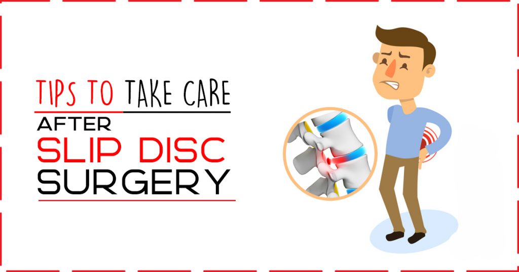 Tips To Take Care after Slip Disc Surgery