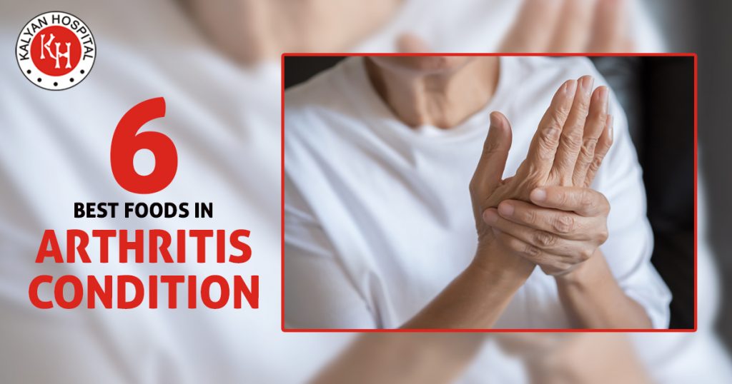 6 Best Foods in Arthritis Condition
