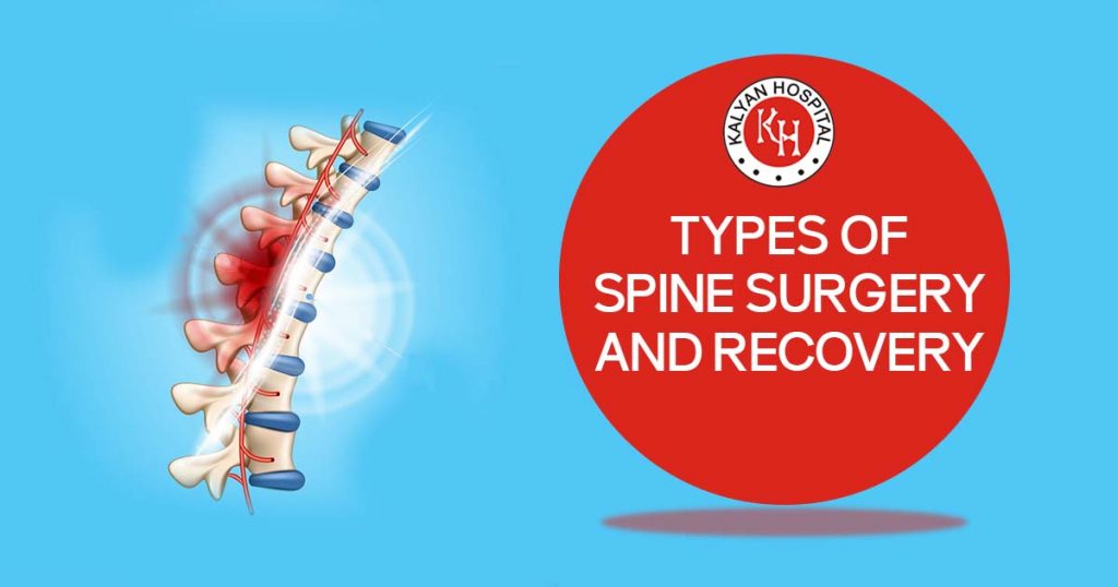 Types of Spine Surgery And Recovery