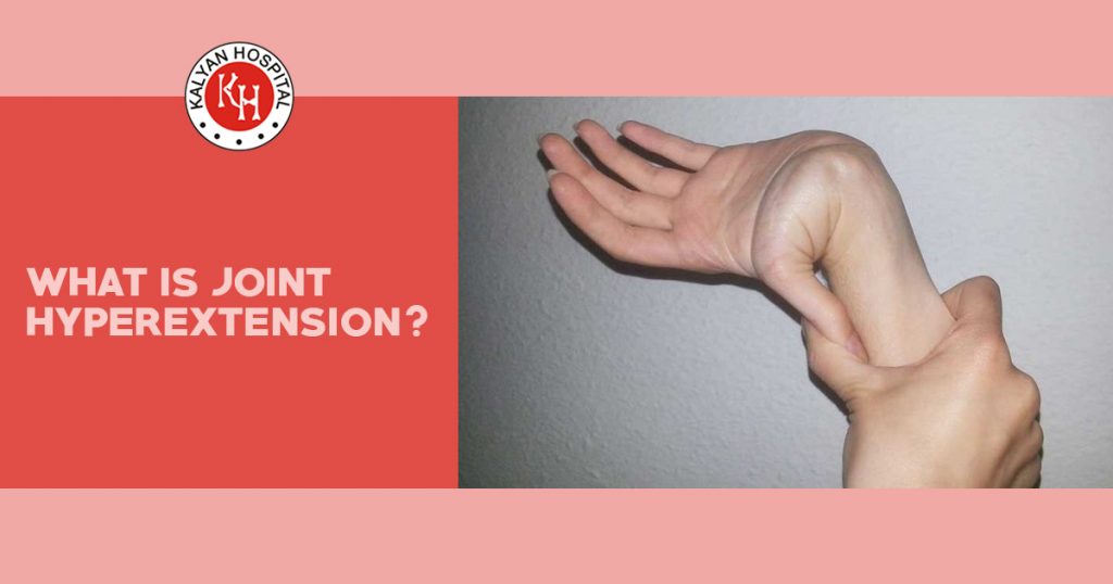 What is Joint Hyperextension