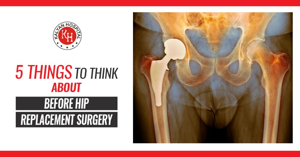 5 Things to think about before hip replacement surgery