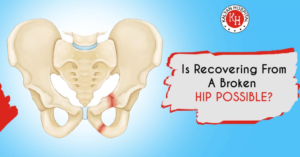 Is recovering from a broken hip possible