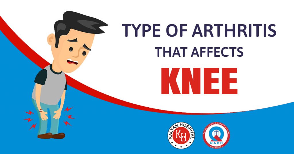 Type of Arthritis that affects knee