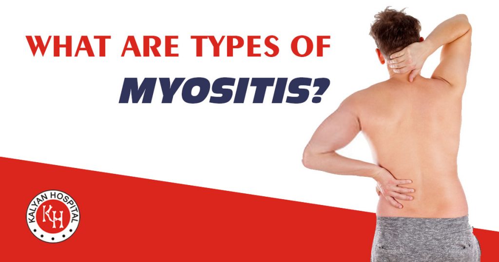 What are types of Myositis