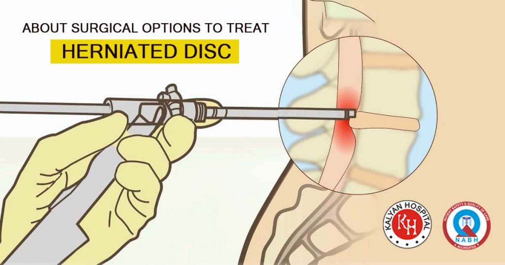 About Surgical Options to treat Herniated Disc
