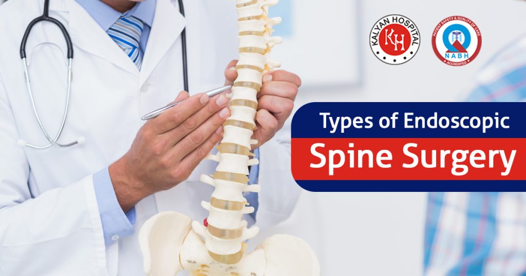 Types of Endoscopic Spine Surgery