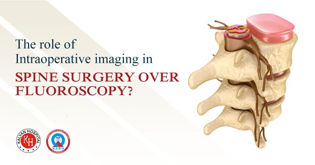 the role of intraoperative imaging in spine surgery over Fluoroscopy