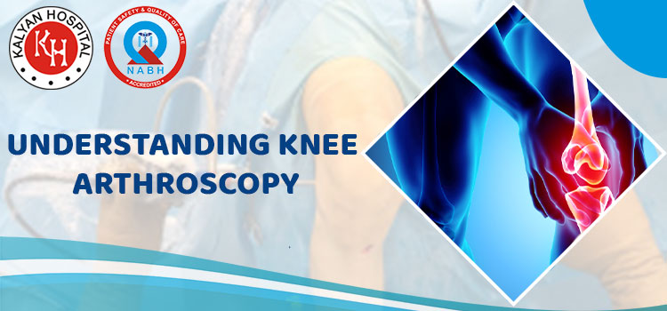 Understanding Knee Arthroscopy
