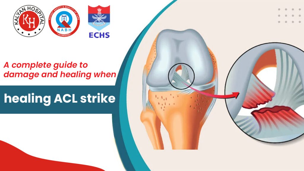 A complete guide to damage and healing when healing ACL strike.